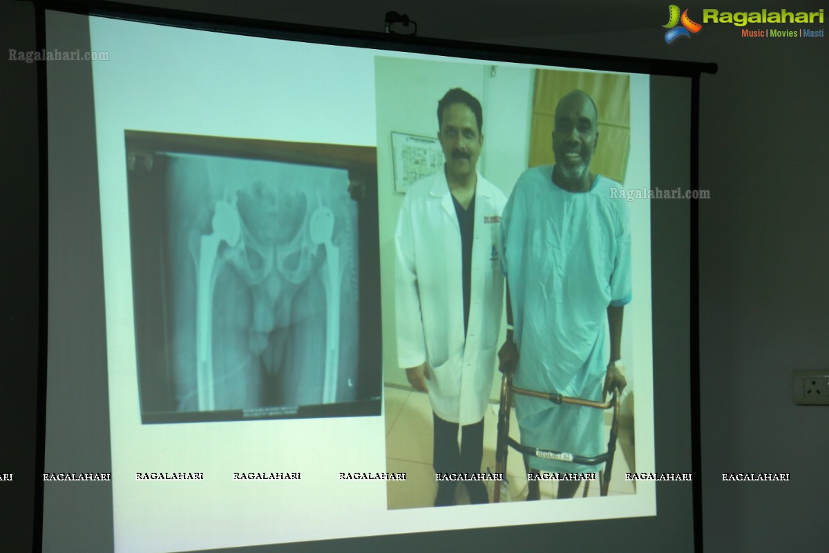 Orthopedic Surgeons at Apollo Perform Double Hip Surgery on a Somalian Patient, Who Walks Freely After 31 Years