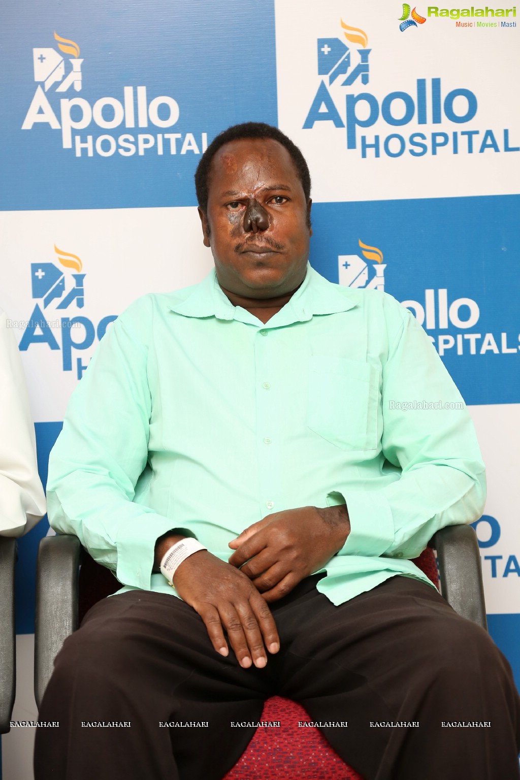 Apollo Hospitals Press Conference