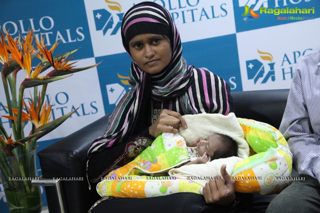 Apollo Hospitals - Successful Cardiac Surgery to a 11 day baby, Hyderabad